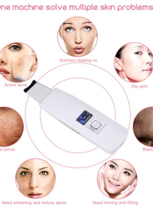 Ultrasonic Skin Scrubber Face Cleanser Blackhead Acne Removal Facial Spa Vibration Massager Ultrasound Peeling Clean Machine 394