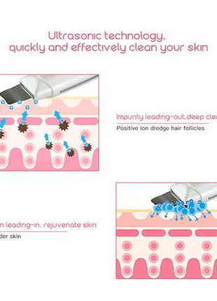 Ultrasonic Skin Scrubber Face Cleanser Blackhead Acne Removal Facial Spa Vibration Massager Ultrasound Peeling Clean Machine 394