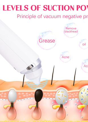 Vacuum Blackhead Analyzer With 6 Suction Heads